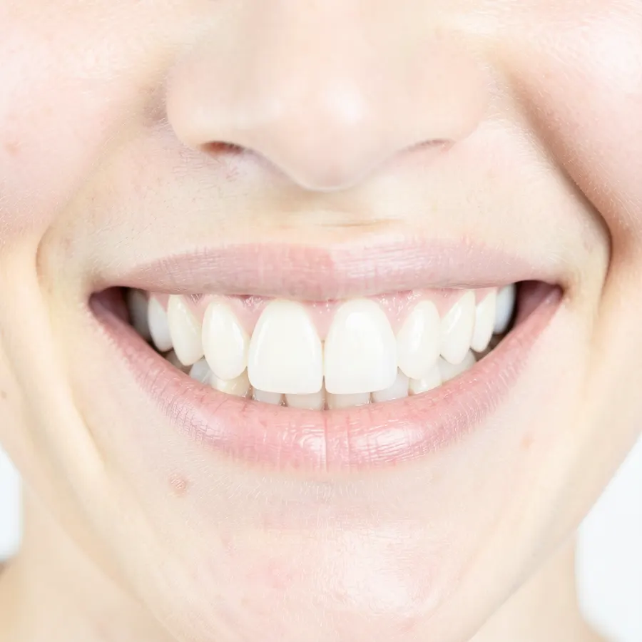 Dental Care